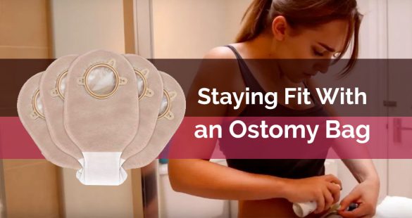 Staying Fit With An Ostomy Bag 2022 | My Fit Station