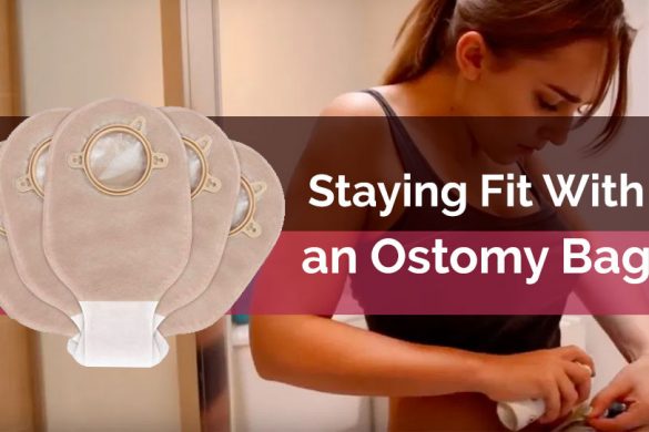 Staying Fit With An Ostomy Bag