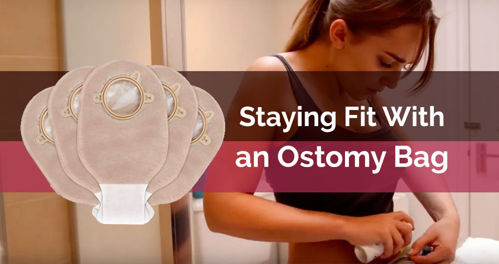 Staying Fit With an Ostomy Bag